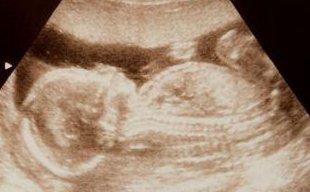 2026山东青岛试管助孕医院介绍