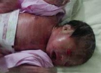 2026年中部战区总医院三代试管攻略，附详细流程与注意事项